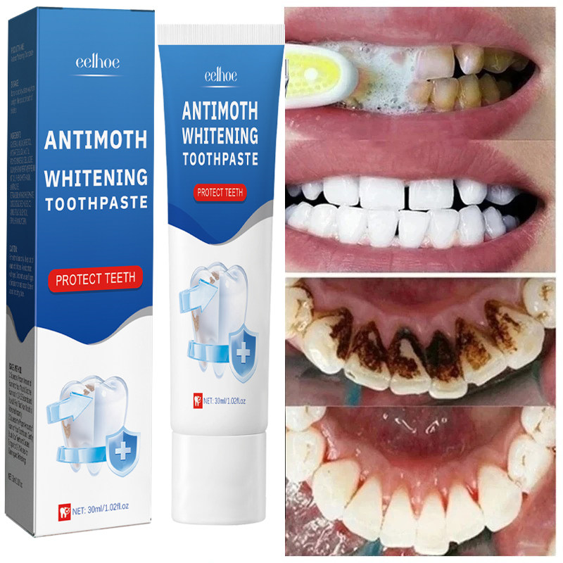 Teeth Whitening Fast - Cepat Menghilangkan Noda Asap Pasta Gigi