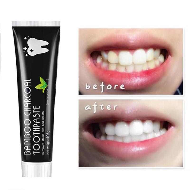 Teeth Whitening Charcoal - Pasta Gigi Pemutih Gigi Arang Aktif
