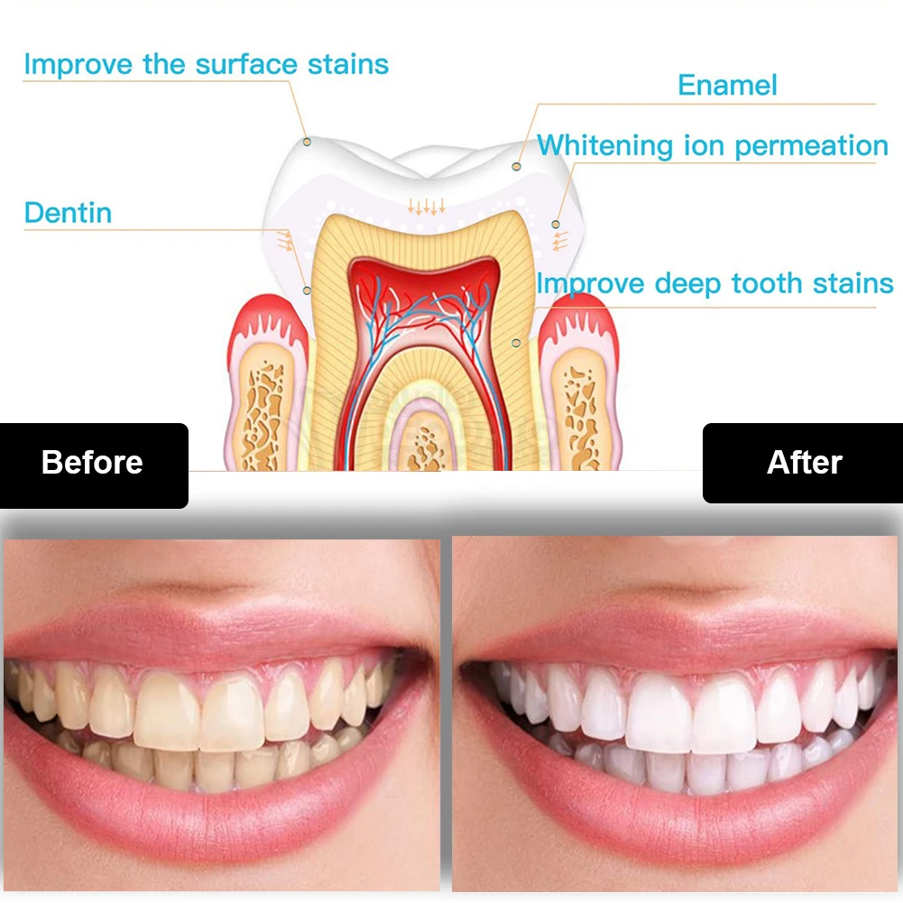 Kit pemutih gigi Mini 16 LED c - Teeth Whitening Foam ulasan dan harga