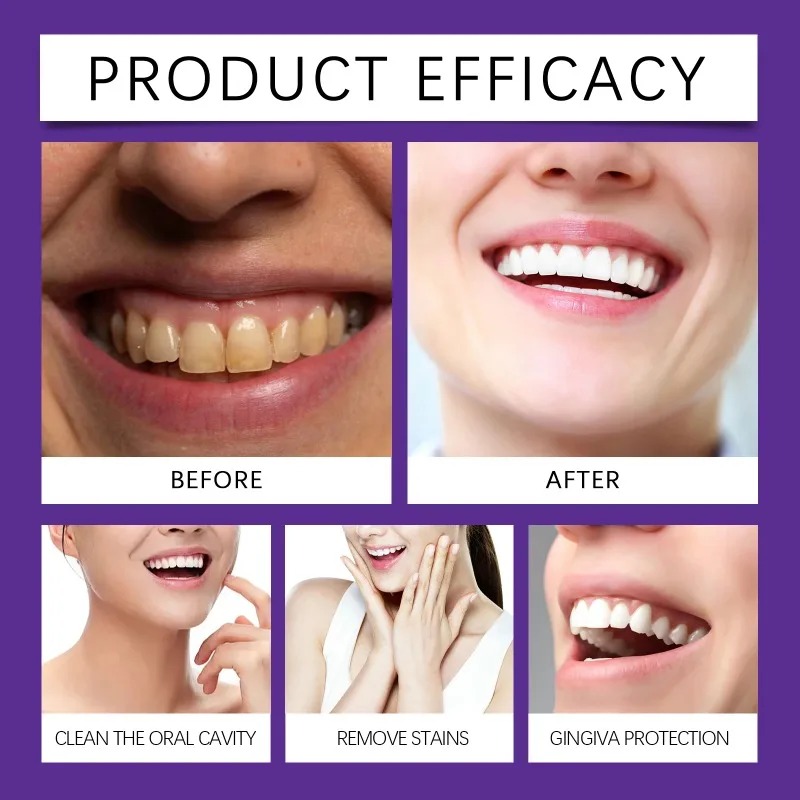 Bubuk Mineral Restorasi Gigi U - Teeth Paint Whitening ulasan dan harga